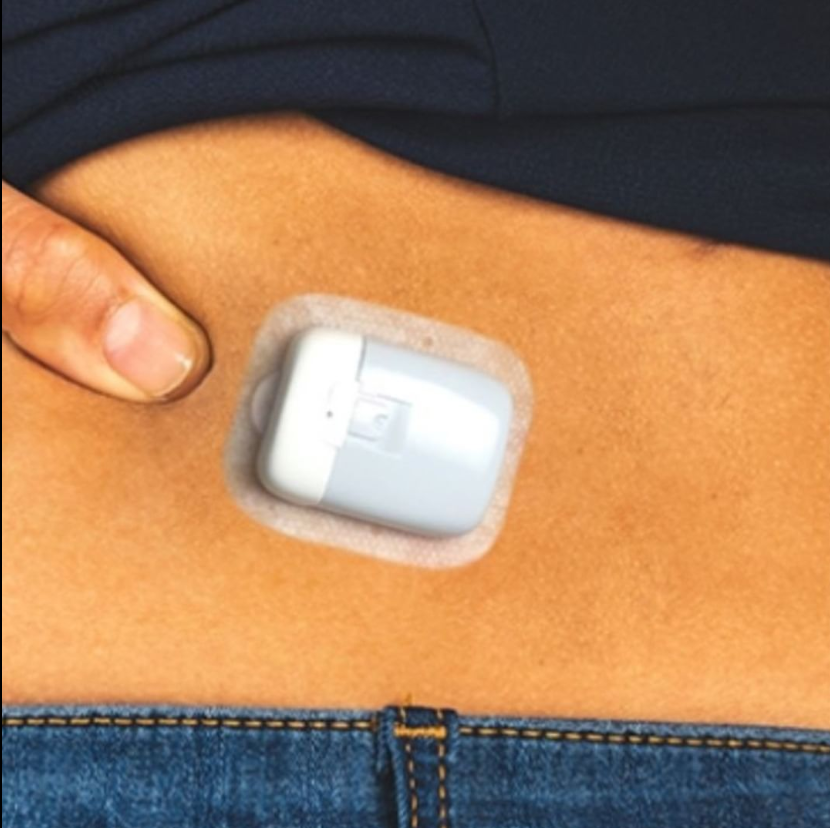 Pompe à insuline Nano Touchcare Medtrum sur l'abdomen